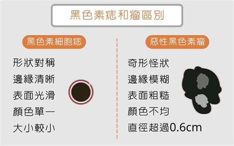 長痣位置|為什麼臉上的痣越來越多？皮膚科醫師解析長痣原因、治療方式